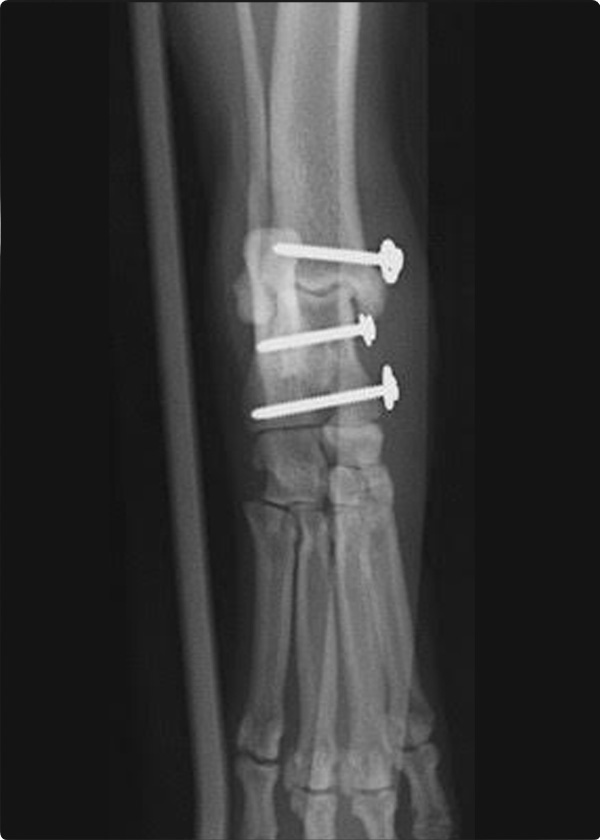 脱臼・亜脱臼・不安定症