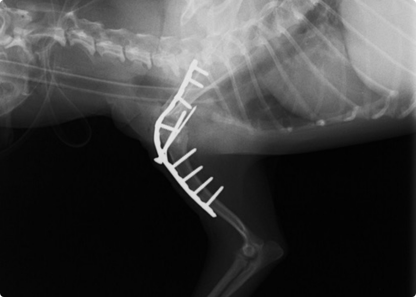 肩関節不安定症・肩関節脱臼